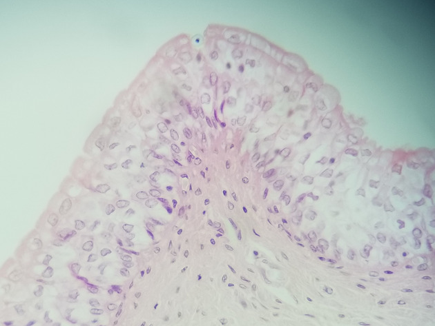 Transitional Epithelium Slides - Transitional Epithelium 08 400X
